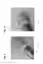Fig. 07 - Thread protector