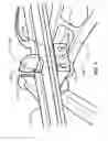 Fig. 08 - Accessories, devices systems, and methods for retaining and stabilizing archery and other equipment