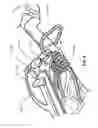 Fig. 09 - Accessories, devices systems, and methods for retaining and stabilizing archery and other equipment