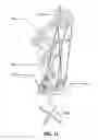 Fig. 12 - Accessories, devices systems, and methods for retaining and stabilizing archery and other equipment