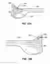 Fig. 16 - Accessories, devices systems, and methods for retaining and stabilizing archery and other equipment