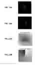 Fig. 16 - Systems and methods for 3D surface measurements