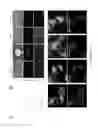 Fig. 08 - Development of ABCG2-Sensitive Fluorescent Probe For Isolation of ABCG2low Neural Stem/Progenitor Cells