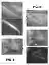 Fig. 09 - Augmented stereoscopic microscopy