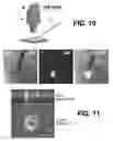 Fig. 10 - Augmented stereoscopic microscopy