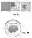 Fig. 11 - Augmented stereoscopic microscopy