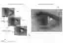 Fig. 01 - Iris recognition via plenoptic imaging