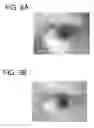 Fig. 06 - Iris recognition via plenoptic imaging