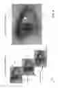 Fig. 05 - Iris recognition via plenoptic imaging