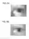 Fig. 06 - Iris recognition via plenoptic imaging