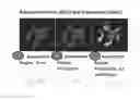 Fig. 08 - METHOD AND SYSTEM FOR ANALYZING BIOLOGICAL SPECIMENS BY SPECTRAL IMAGING
