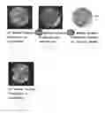 Fig. 09 - METHOD AND SYSTEM FOR ANALYZING BIOLOGICAL SPECIMENS BY SPECTRAL IMAGING