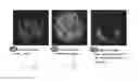 Fig. 10 - METHOD AND SYSTEM FOR ANALYZING BIOLOGICAL SPECIMENS BY SPECTRAL IMAGING