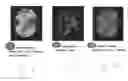 Fig. 12 - METHOD AND SYSTEM FOR ANALYZING BIOLOGICAL SPECIMENS BY SPECTRAL IMAGING