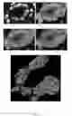 Fig. 28 - Systems and methods for segmentation and processing of tissue images and feature extraction from same for treating, diagnosing, or predicting medical conditions