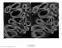 Fig. 33 - Systems and methods for segmentation and processing of tissue images and feature extraction from same for treating, diagnosing, or predicting medical conditions