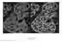 Fig. 34 - Systems and methods for segmentation and processing of tissue images and feature extraction from same for treating, diagnosing, or predicting medical conditions