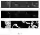 Fig. 37 - Systems and methods for segmentation and processing of tissue images and feature extraction from same for treating, diagnosing, or predicting medical conditions