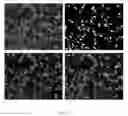Fig. 45 - Systems and methods for segmentation and processing of tissue images and feature extraction from same for treating, diagnosing, or predicting medical conditions