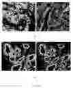 Fig. 52 - Systems and methods for segmentation and processing of tissue images and feature extraction from same for treating, diagnosing, or predicting medical conditions
