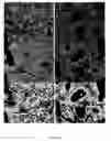 Fig. 54 - Systems and methods for segmentation and processing of tissue images and feature extraction from same for treating, diagnosing, or predicting medical conditions