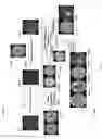 Fig. 12 - Quantifying mass effect deformation with structural radiomics in brain tumor patients