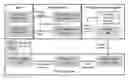 Fig. 01 - Systems and methods of choroidal neovascularization detection using optical coherence tomography angiography