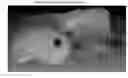 Fig. 01 - Apparatus and method of texture mapping for dental 3D scanner