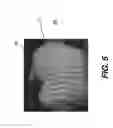 Fig. 07 - Apparatus and method of texture mapping for dental 3D scanner