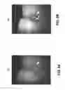 Fig. 08 - Apparatus and method of texture mapping for dental 3D scanner