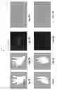 Fig. 06 - Methods and systems for 3D contour recognition and 3D mesh generation