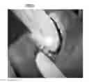 Fig. 01 - Intraoral scanner with dental diagnostics capabilities