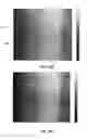 Fig. 16 - Intraoral scanner with dental diagnostics capabilities