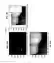 Fig. 22 - Intraoral scanner with dental diagnostics capabilities