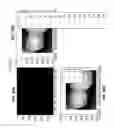 Fig. 23 - Intraoral scanner with dental diagnostics capabilities