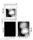 Fig. 24 - Intraoral scanner with dental diagnostics capabilities