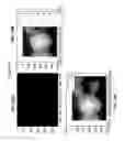 Fig. 25 - Intraoral scanner with dental diagnostics capabilities