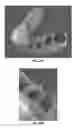 Fig. 28 - Intraoral scanner with dental diagnostics capabilities