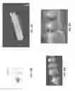 Fig. 30 - Intraoral scanner with dental diagnostics capabilities