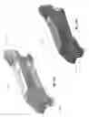 Fig. 32 - Intraoral scanner with dental diagnostics capabilities
