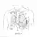 Fig. 03 - Automatic thresholds for atrial tachyarrhythmia detection in an implantable medical device