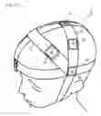 Fig. 12 - Electroencephalogram electrode