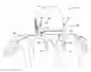 Fig. 01 - Device to reduce traumatic brain injury