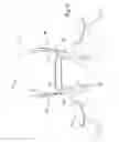 Fig. 03 - Device to reduce traumatic brain injury