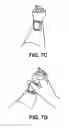 Fig. 09 - Blood sampling system and method