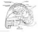 Fig. 02 - ELECTRONIC CATHETER STETHOSCOPE