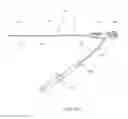 Fig. 03 - Apparatus and methods for sealing a vascular puncture