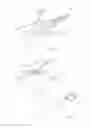 Fig. 02 - Grasper needle closure device