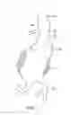 Fig. 02 - Stent graft delivery system