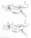Fig. 06 - Stent graft delivery system